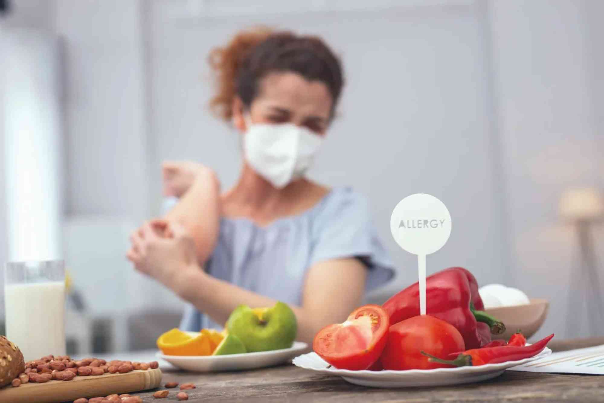 Food Allergy Unspecified Icd 10