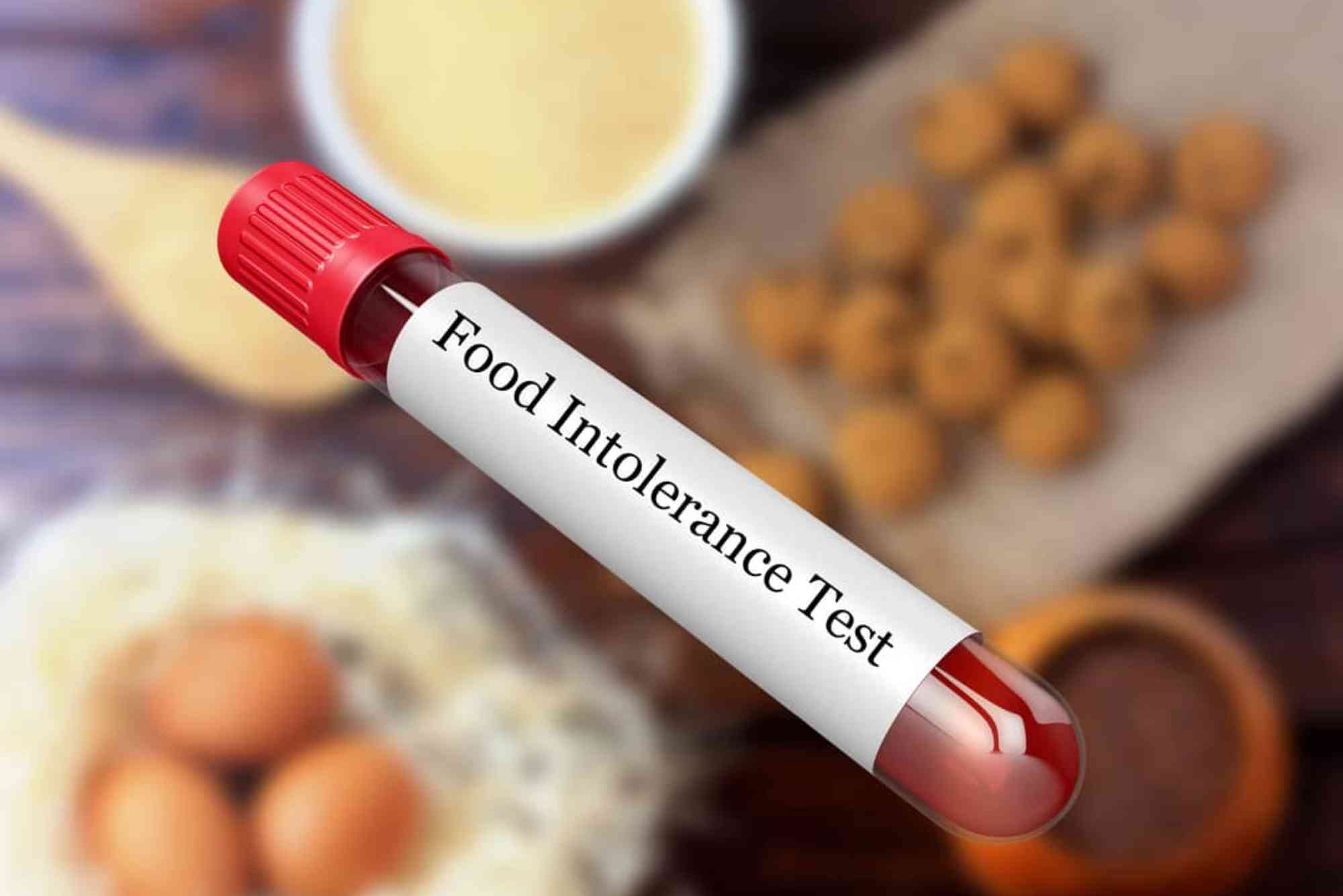 Food Chemical Intolerance